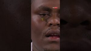 Ally Pally wasp lands on David Munyua's face 🐝 😳